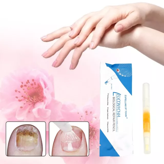 3ml Anti Fungal Nail Treatment Finger Toe Care Nail Fungus Treatment Liquid Pen