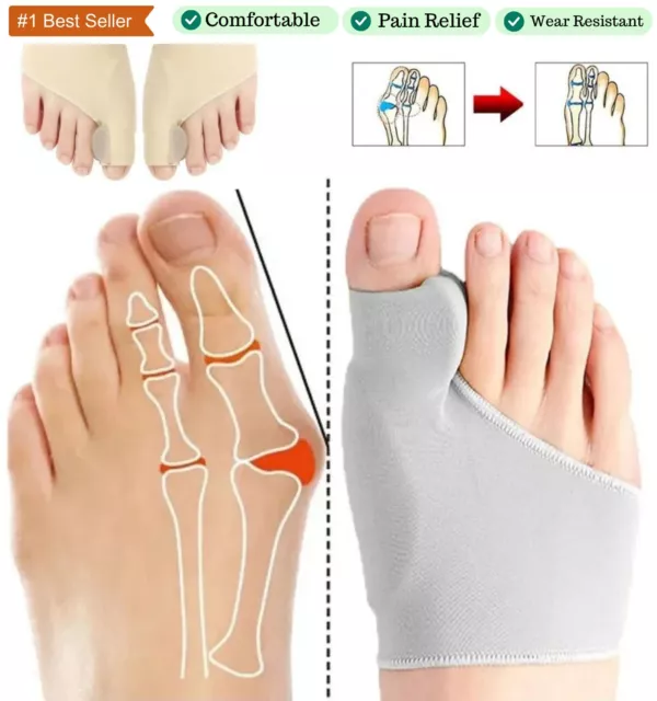 2PCS Big Toe Bunion Corrector Splint Straightener Feet Pain Relief Hallux Valgus