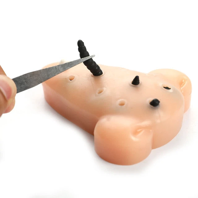 BLACKHEAD SHAPE PIMPLE Toys Squeeze Acne Stress Relief Toys Remover