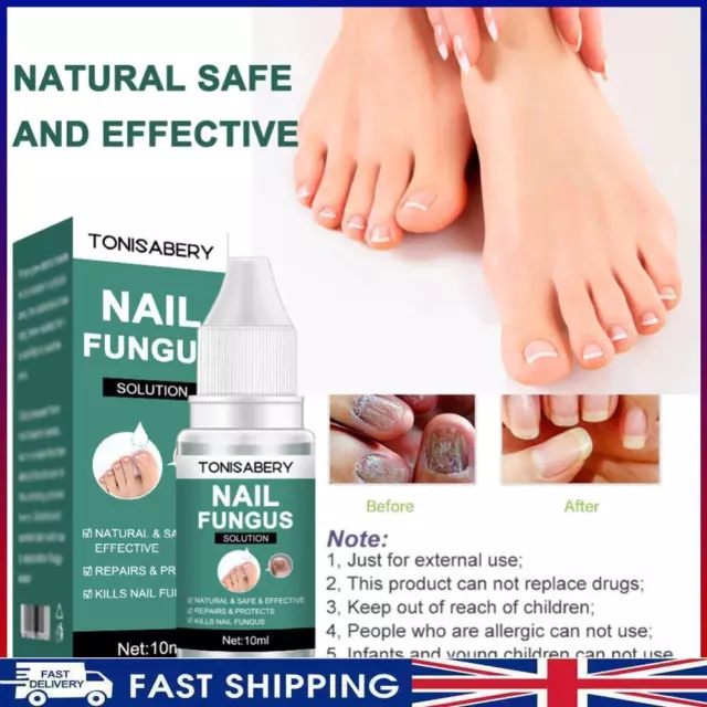 # 10ml Fungus Removal Gel Effective Repair Nail Essence Multipurpose for Foot Ca