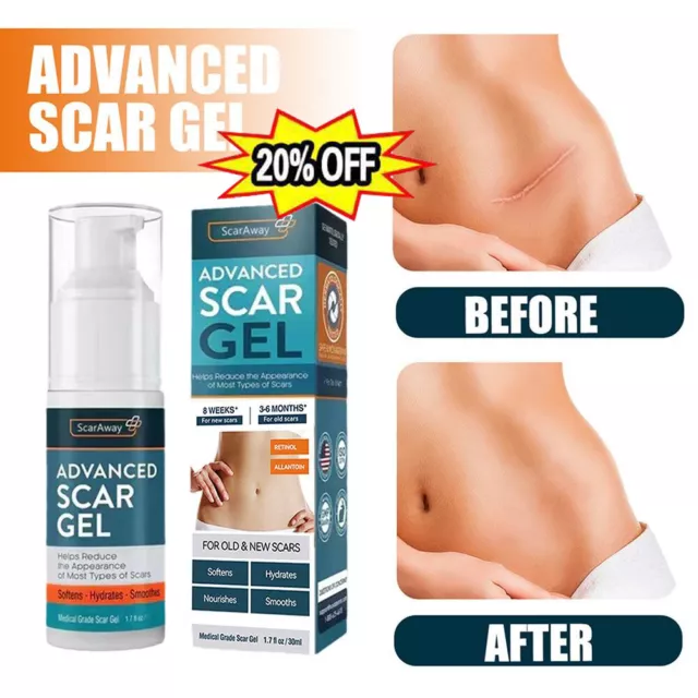 2PCS ScarAway Advanced Scar Gel, Beauty Medical Grade Scars Gel Old & New Scars`