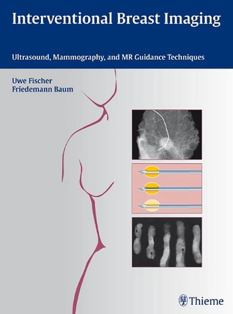 INTERVENTIONAL BREAST IMAGING: Ultrasound, Mammography, and MR Guidance ...