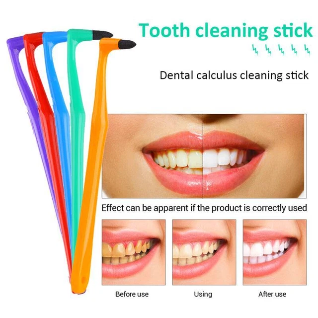✅ Rimuovi placca tartaro bastone denti dentale rimozione calcolo denti