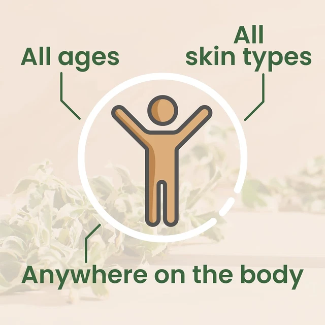 BALMONDS SKIN SALVATION Eczema Cream 60ml Eczema, Psoriasis and