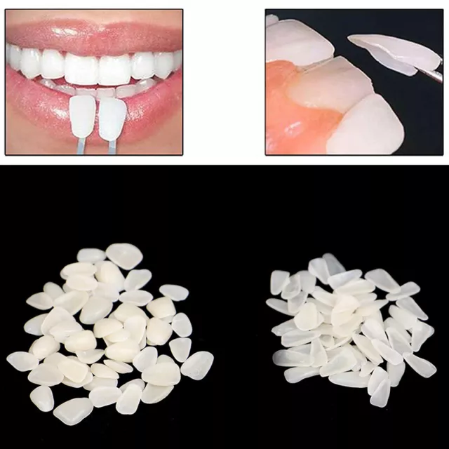 60Pcs Dental Ultra-Thin Whitening Veneers Resin Temporary Teeth Whitening'm' G1