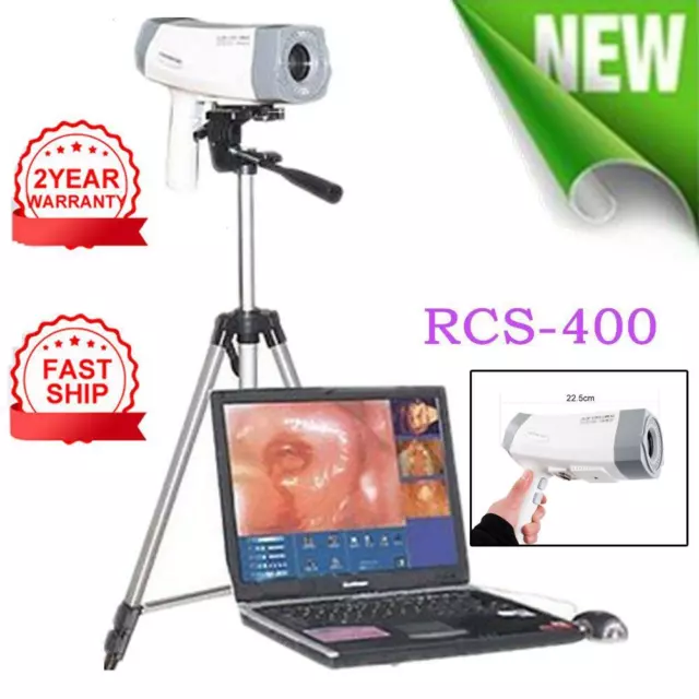 High-Res Vaginal Colposcope Camera + Software - Trusted Seller