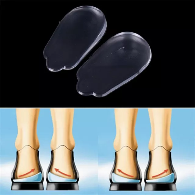 Shoes Pad Leg Varus Orthotics X/O Type Legs Correction Brioche Silicone Insole