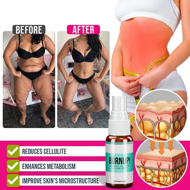 Muslo BurnUp Ultimates Cellulite Spray Calefacción Fixificante Piel Estiramiento