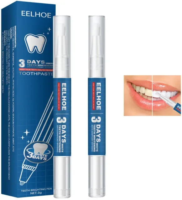 2 Penne kit sbiancamento denti,gel rimuovi macchie,igiene orale*Teeth Whitening.