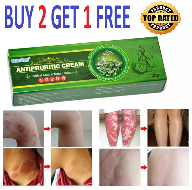 Natural Body Psoriasis Eczema Rosacea Cream Ointment Gel Body Skin Care