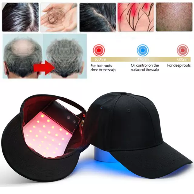 650nm Red LED Light Therapy Hat Hair Regrowth Hair growth Anti-Hair Loss Cap 2