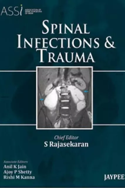 Spinal Infections and Trauma by S. Rajasekaran (English) Hardcover Book