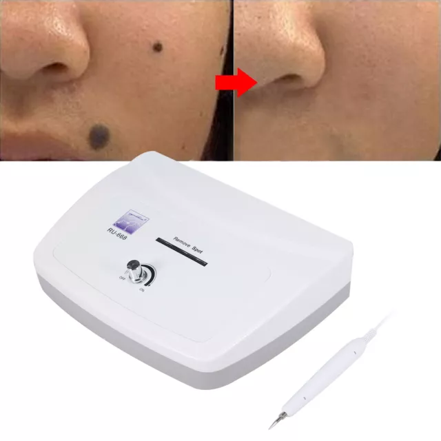 Professional Electronic Mole Spot Removal Machine Freckle Tattoo Remover Pen