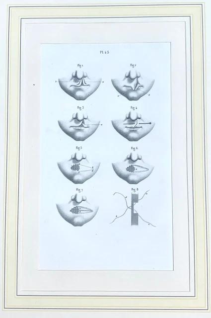 Anatomische Zeichnung: Huette E. Bernard, ca. 1850