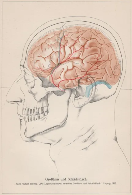 Mensch Großhirn und Schädeldach Gehirnlagerung LITHOGRAPHIE von 1911