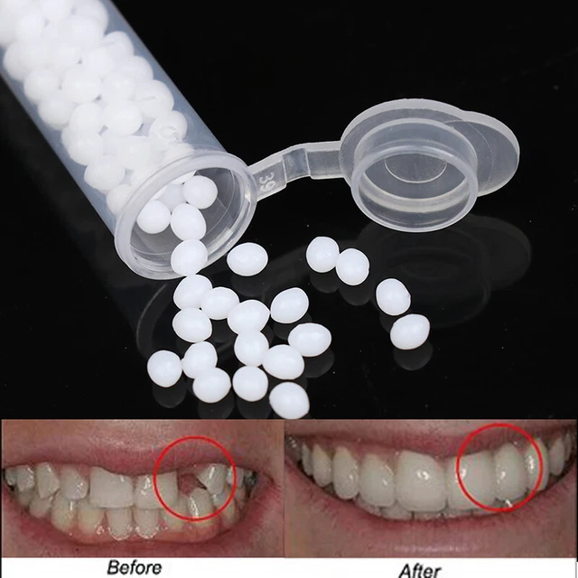 Temporary Tooth Repair Kit Teeth And Gaps False Teeth Solid Glue D.zy