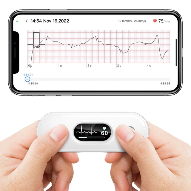 ECG EKG HEART Monitor Smartphone compatible free App 30s - 5 Min ...