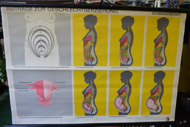 Schulwandkarte Rollkarte Lehrtafel Aufklärung Geburt - die Schwangerschaft 1960
