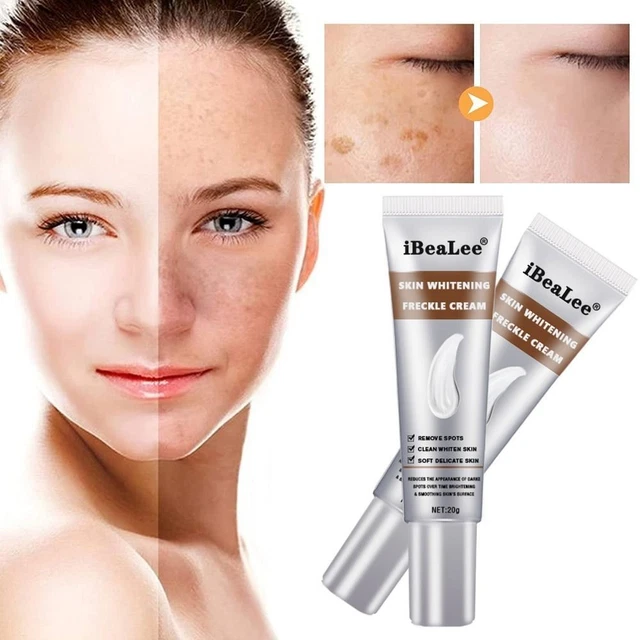 aclarador facial crema aclarador removedor de pecas crema