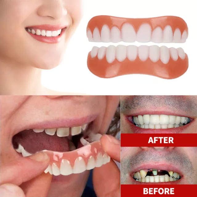 Braces Tooth Denture Veneers Snap On False Teeth Upper Lower Fake Cover Dental