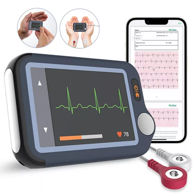 Portable EKG ECG Monitor Wireless Smartphone Accurate Fast Results Brand New UK