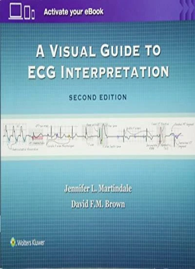 A VISUAL GUIDE to ECG Interpretation, Martindale, Brown 9781496321534 ...