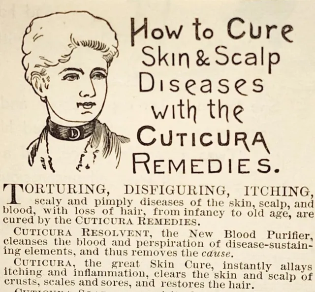 1887 Cuticura Victorian Quack Medicine Potter Boston Advertisement 3x2.5