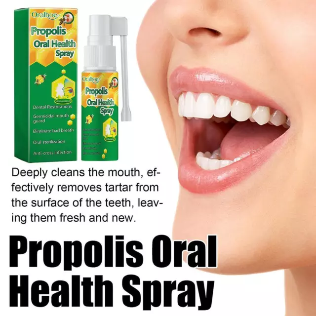 20ml Propolis Oral Spray to Clean Teeth Stains, Remove Odor and Freshen Mouth