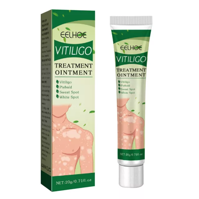 20 g crema trattamento vitiligine promozione melanina sudore crema macchie forniture per la cura della pelle