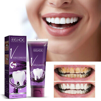 Pasta de dientes púrpura blanqueamiento dental eliminación de manchas para una limpieza más blanca.