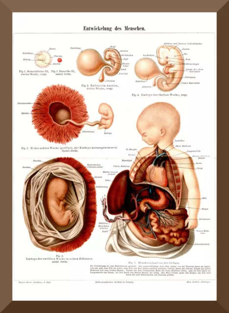 +ENTWICKLUNG DES MENSCHEN+ wunderschöne Chromolitho 1895 +Embryo,Geburt,Baby+