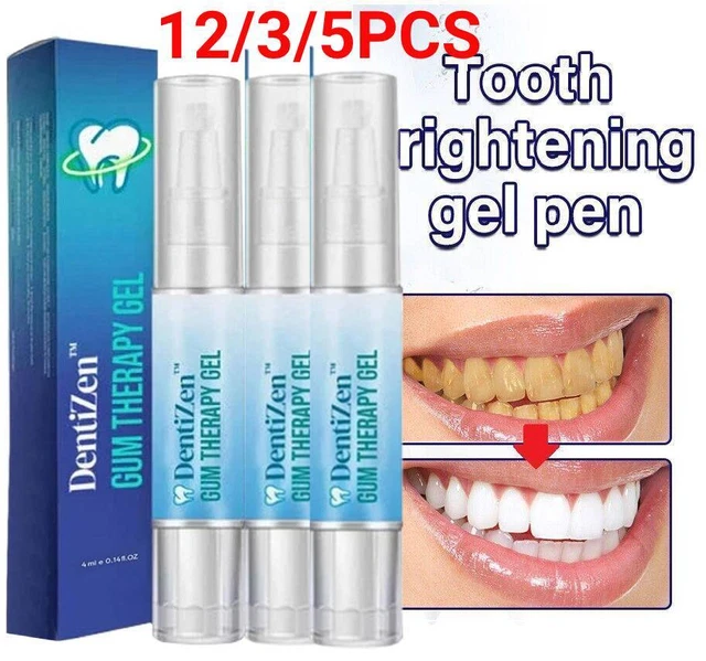 I Nostri 10 Migliori Penna Sbiancante Per Denti In Italia - Foto 3