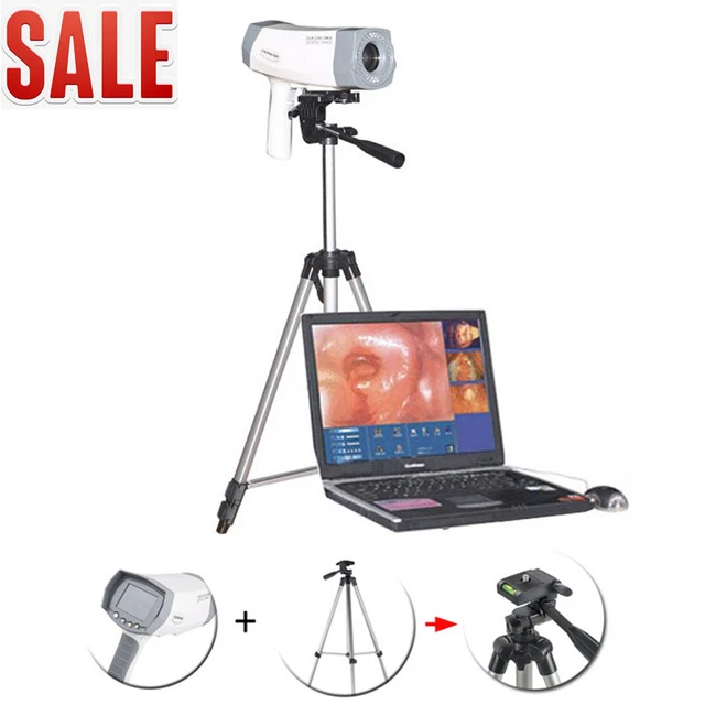 Carejoy Hospital Electronic Colposcope 1/4 inch Color Digital USA+Tripod New