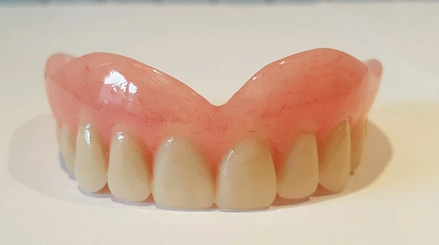 Oberkiefer-Zahnprothese Ohne Gaumen – Hufeisenform, Dental, Gebiss, Zahnersatz, Komfortabler Sitz