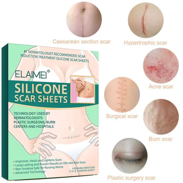 Rimozione cicatrici in silicone riutilizzabile gel terapia acne patch bruciore pelle trauma foglia D0S5
