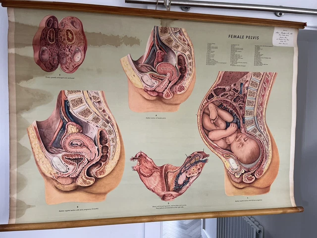 ANTIQUE VINTAGE ADAM Rouilly Wall Chart Poster Medical Female Pelvis £ ...