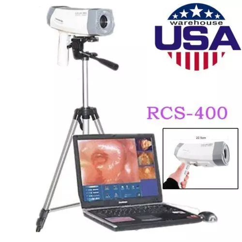 Medical Color Electronic Colposcope 800000 Pixels Camera Video+Tripod Hospital