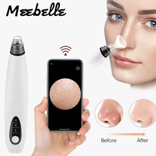 WIFI Electric Blackhead Remover Vacuum Cleaner Visual Face Cleansing Skin Care