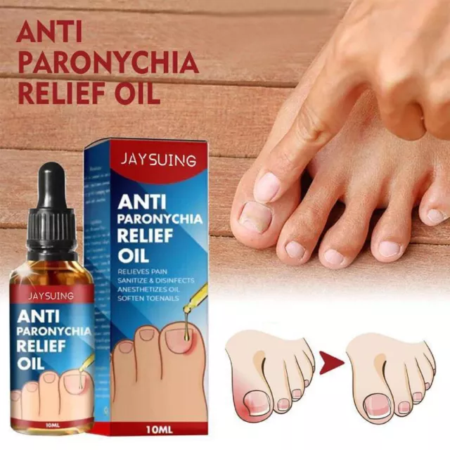 2023 Mejores aceites antiparónicos alemanes para aliviar las uñas EE. UU.
