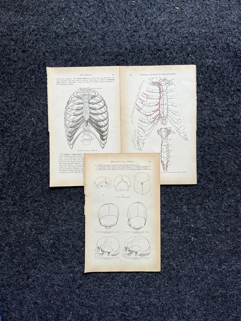 ORIGINAL 1913 ANATOMY Pages of Human Body, Anatomy Physiology Textbook ...