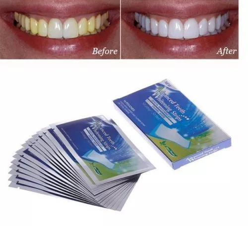 ADVANCED TEETH 14 pouches/ 28 bandes kit blanchiment des dent blanche dents gel