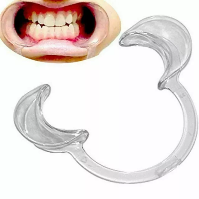 Wangenretraktoren Zähneaufhellender Lippenmundöffner Halter Retraktor oral zahnärztlich
