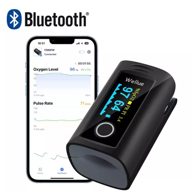 CE approval Pulse Oximeter with free App Blood Oxygen Heart Rate Monitor SpO2