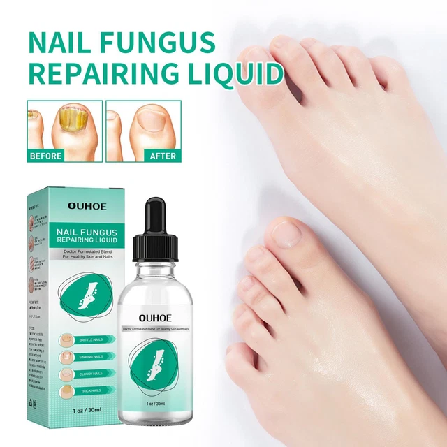 Kerassentials For Toenail Fungus Kerassentials Toenail 30ml Oil Fungus N3A0