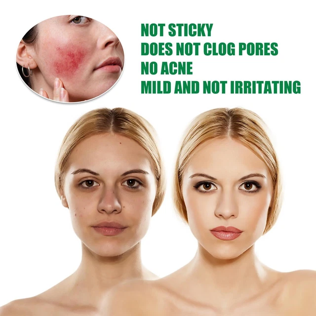 Spray sedativo riparatore aloe vera per acne - scottature solari sollievo K4M2