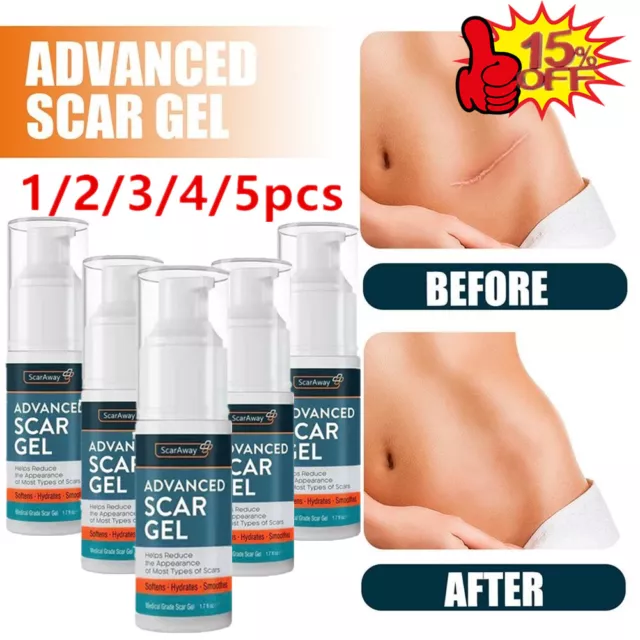 1/2/3/5 Stk. ScarAway Advanced Narbengel 30ML