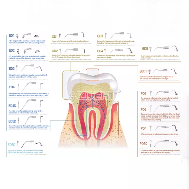 19 types d'échalonneurs dentaires à ultrasons échalonnage endo conseils de période adaptés pour NSK SATELEC DTE 2