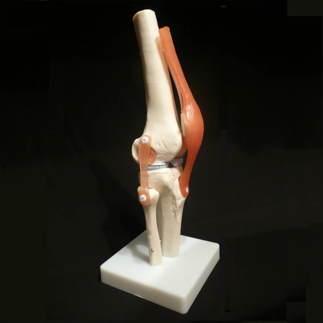 ANATOMICAL HUMAN DEGENERATIVE Knee Joint Disease Model Medical Skeleton