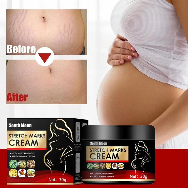 · Riparazione smagliatura olio essenziale cicatrice smagliatura smagliatura gravidanza rimozione crema P2R5