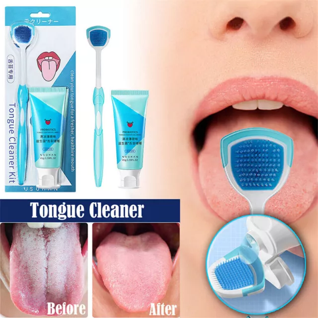 Raschietto Pulisci Lingua Igiene Dentale Bocca Orale + Gel Pulizia Lingua -